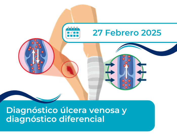 Webinar úlcera venosa diagnostico